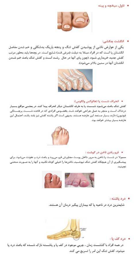 عوارض کفش تنگ و پاشنه بلند