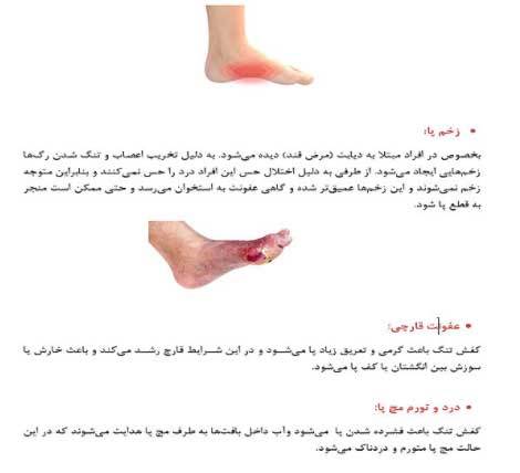 عوارض کفش تنگ و پاشنه بلند