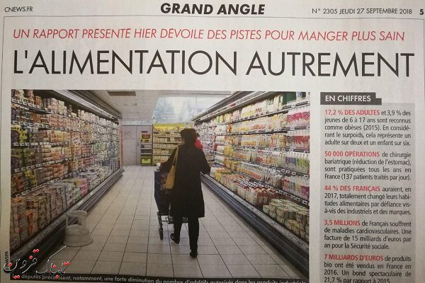 روزانه ۱۳۷ فرانسوی معده خودشان را کوچک میکنند! روزانه ۱۳۷ فرانسوی معده خودشان را کوچک میکنند!