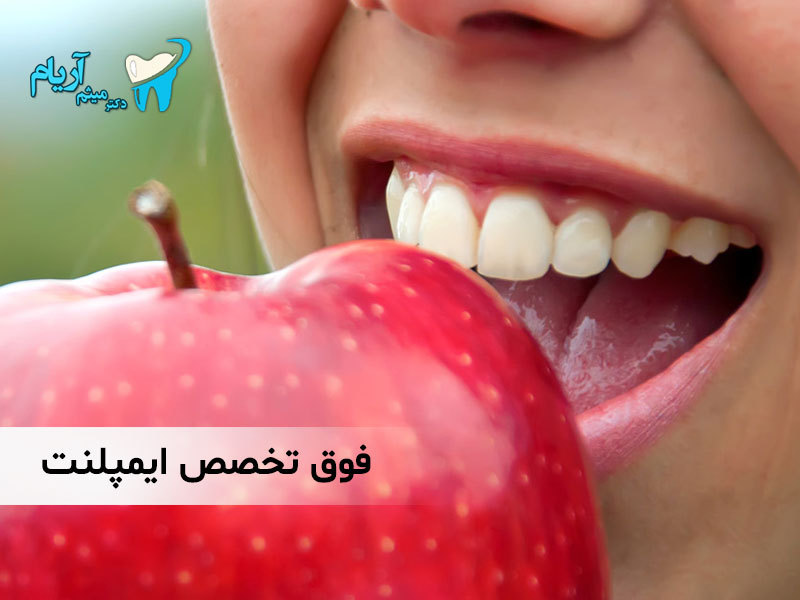 بهترین متخصص ایمپلنت تهران را بشناسید بهترین متخصص ایمپلنت تهران را بشناسید