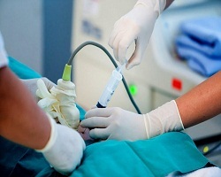 آمنیوسنتز آزمایشی تشخیصی قبل از تولد جنین