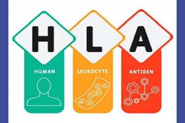 آزمایش H.L.A روشی برای درمان بیماریهای صعبالعلاج